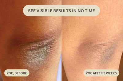 Dr. Melaxin - Peel Shot Serum