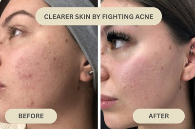 Dr. Melaxin - Peel Shot Serum