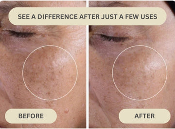 Dr. Melaxin - Peel Shot Serum