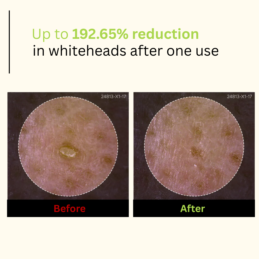 Dr. Melaxin - Peel Shot Serum