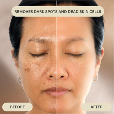 Dr. Melaxin - Peel Shot Serum